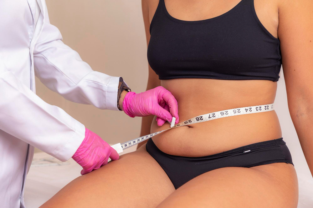 Liposucția: Analiză avantaje și riscuri pentru corpul tău